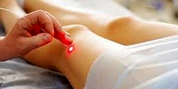 İngiltere varis tedavisinde artık lazeri tercih edecek