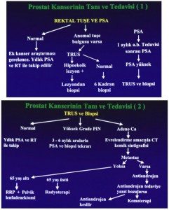 prostat-kanseri3