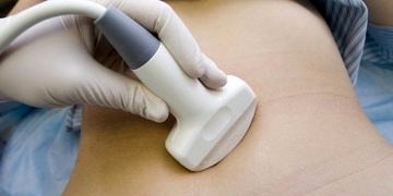 Gebelikte ultrasonografi ne kadar güvenli?