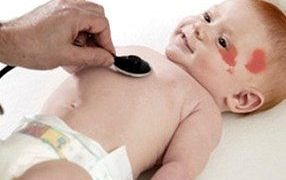 Vasküler anomaliler tanı ve tedavisi