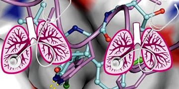 Akciğer kanseri tanı ve tedavi planlarında neler değişti?
