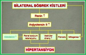 bobrek-kalitsal-kistik-hastalik2