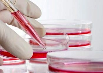 Yeni genetik biobelirteç Alzheimer teşhisinde devrim yaratabilir