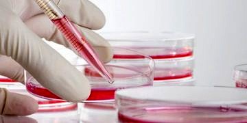 Yeni genetik biobelirteç Alzheimer teşhisinde devrim yaratabilir