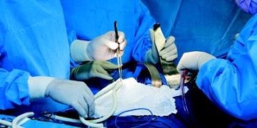 Çoklu damar tıkanıklıklarında ilk tercih: by-pass mı olmalı?