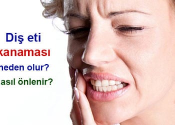 Diş eti kanaması neden olur? Nasıl önlenir? Doğal tedavisi