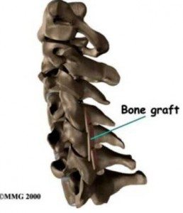 fizik tedavi boyun ağrısı