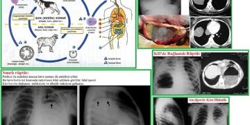 Kist hidatik (akciğer kisti) belirtileri, tanı ve tedavisi