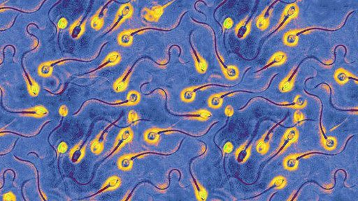 sperm