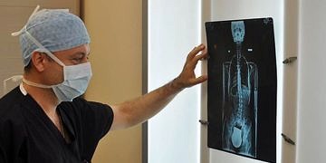 Gebelikte skolyoz ile ilgili bilmeniz gereken önemli detaylar