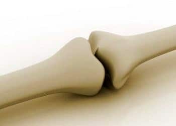 Basit kemik kisti, hangi yaşlarda görülür? Belirtileri ve tedavisi