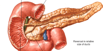 Akut Pankreatit tanı ve tedavisi