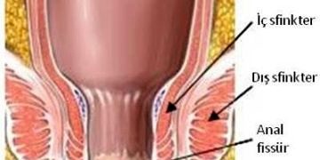 Anorektal bölge hastalıkları tanı ve tedavisi