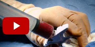 55 yaş üstü hastalara ilik nakli yapılmayacak!