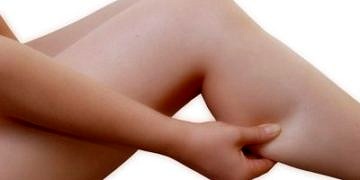 Meme kanseri olan her 4 kadından 1’i lenfödem riski altında