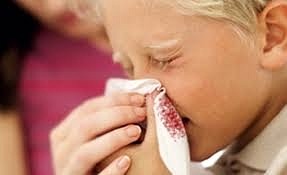 Burun kanaması tehlikeli midir? Kanamaya acil müdahale yöntemleri