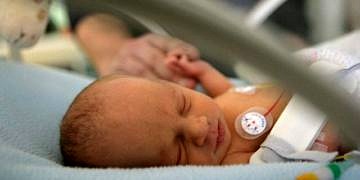 Prematüre bebeklerde körlük tehlikesi; prematüre retinopati (ROP)