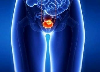 FDA bu ilaca mesane kanseri için ‘çığır açıcı tedavi’ dedi