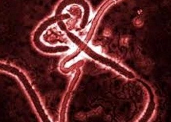 Ebola hastalığının nedeni virüs mü, yoksa eksik hijyen mi?