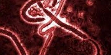 Ebola hastalığının nedeni virüs mü, yoksa eksik hijyen mi?