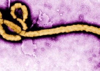 Ebola hastalığının nedeni virüs mü, yoksa eksik hijyen mi?
