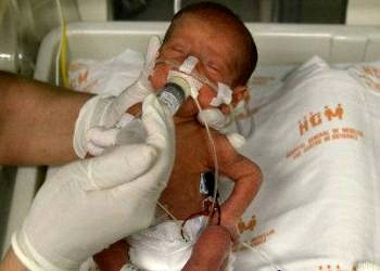 Prematüre bebeklerde ‘beyin hasarını önleyen hormon’ bulundu!