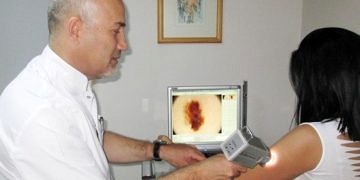 Dijital dermatoskopi ile deri kanserinde erken tanı imkanı