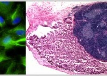 Bilim adamları laboratuvarda  timus organı geliştirmeyi başardı