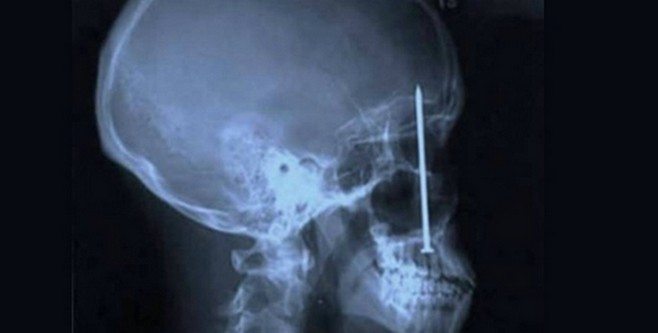 insan-ameliyat-esya-kapak