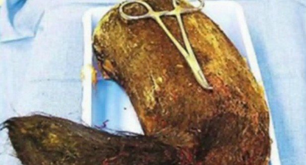 insan-ameliyat-esya1