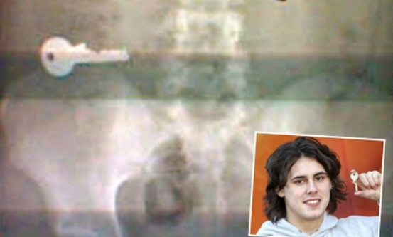 insan-ameliyat-esya11