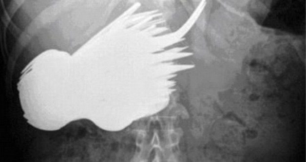 insan-ameliyat-esya3