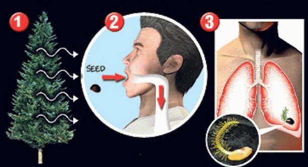 insan-ameliyat-esya6