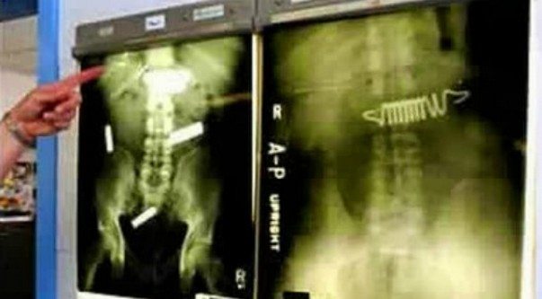 insan-ameliyat-esya8