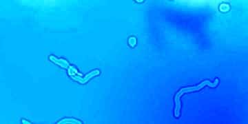 Gözdeki yüzer noktalar tedavi gerektirir mi?