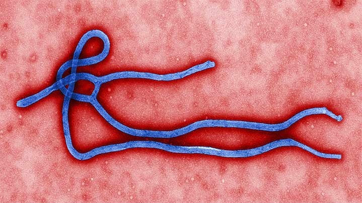 ebola virüsü bakterisi