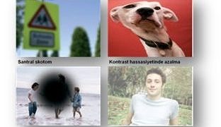 Yaşa bağlı makula dejenerasyonu: Sarı nokta hastalığı nedir?