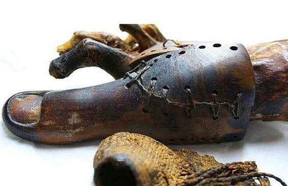 Ayak baş parmağı protezi.. Görüntüsü bile tüyleri ürpertmeye yetiyor