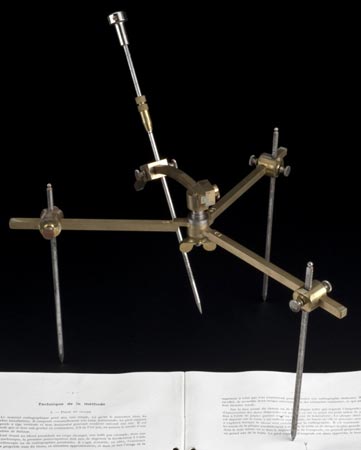 tibbin-korkutucu-tarihi--tip-tarihi-urkutucu-alman-amputasyon-amputasyon-testeresi-fransiz-kursun-cik-982409