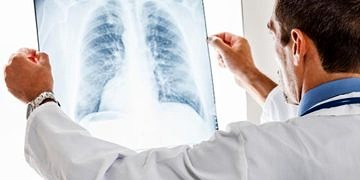 Zatürre, 65 yaş üstü kişilerde daha ağır ve tehlikeli seyrediyor