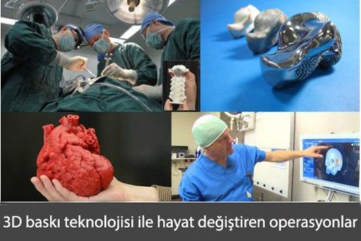 3d-teknolojisi ve ameliyat