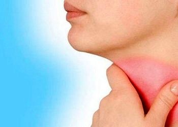 Farenjit nedir? Neden olur? Belirtileri ve tedavi yöntemleri