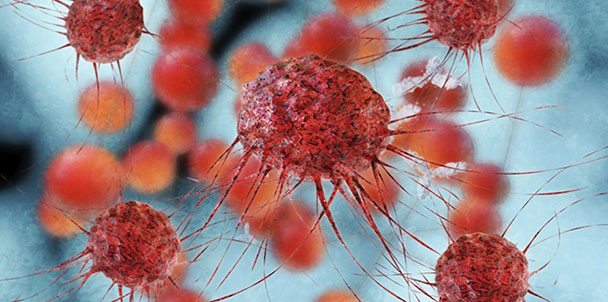 hucre-terapisi-losemi