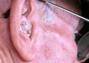 B3 Vitamin takviyesi farelerde gürültüye bağlı işitme kaybını önledi