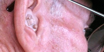 B3 Vitamin takviyesi farelerde gürültüye bağlı işitme kaybını önledi