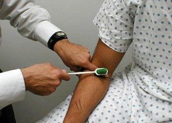 Refleksler ve tonus nedir?