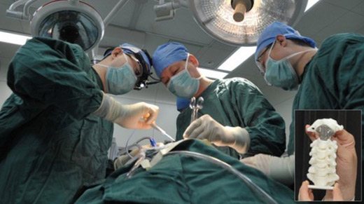 tam-omurga-implantı