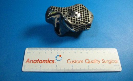 titanyum-topuk-implanti