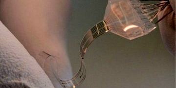 Omurilik felçlileri için tekrar yürüme umudu