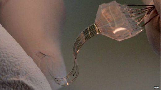 esnek implant-omurilik